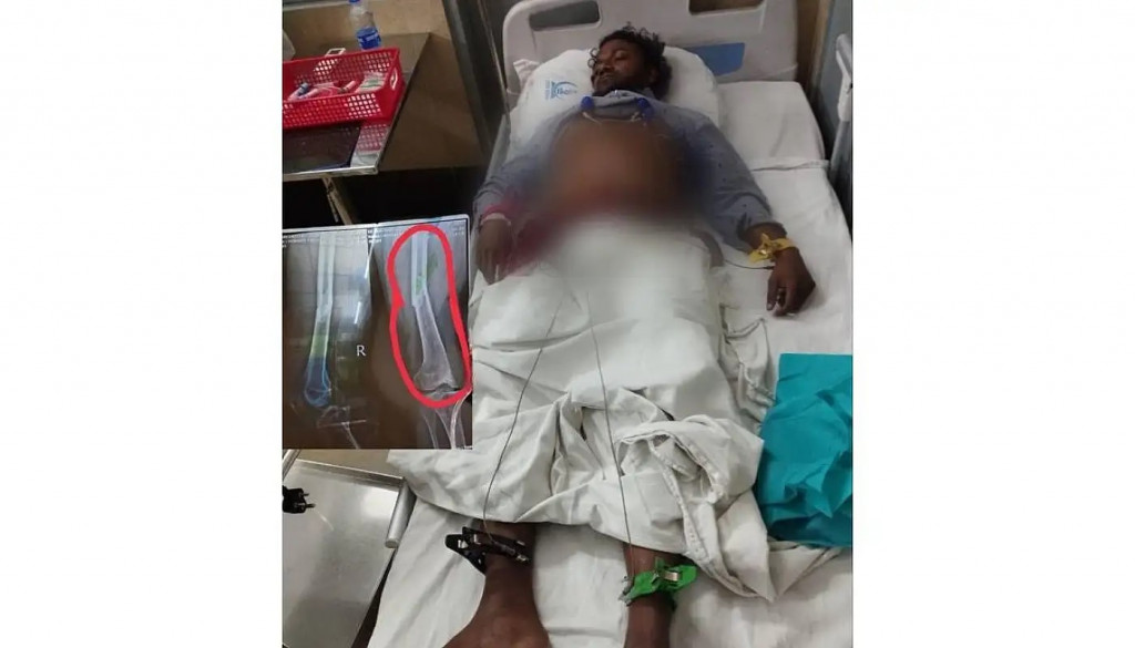 ބަންގްލަދޭޝްގައި މިސްކިތެއް އެޅުމުގެ މަސައްކަތުގައި އުޅުނު ދިވެއްސަކު އެކްސިޑެންޓްވެއްޖެ