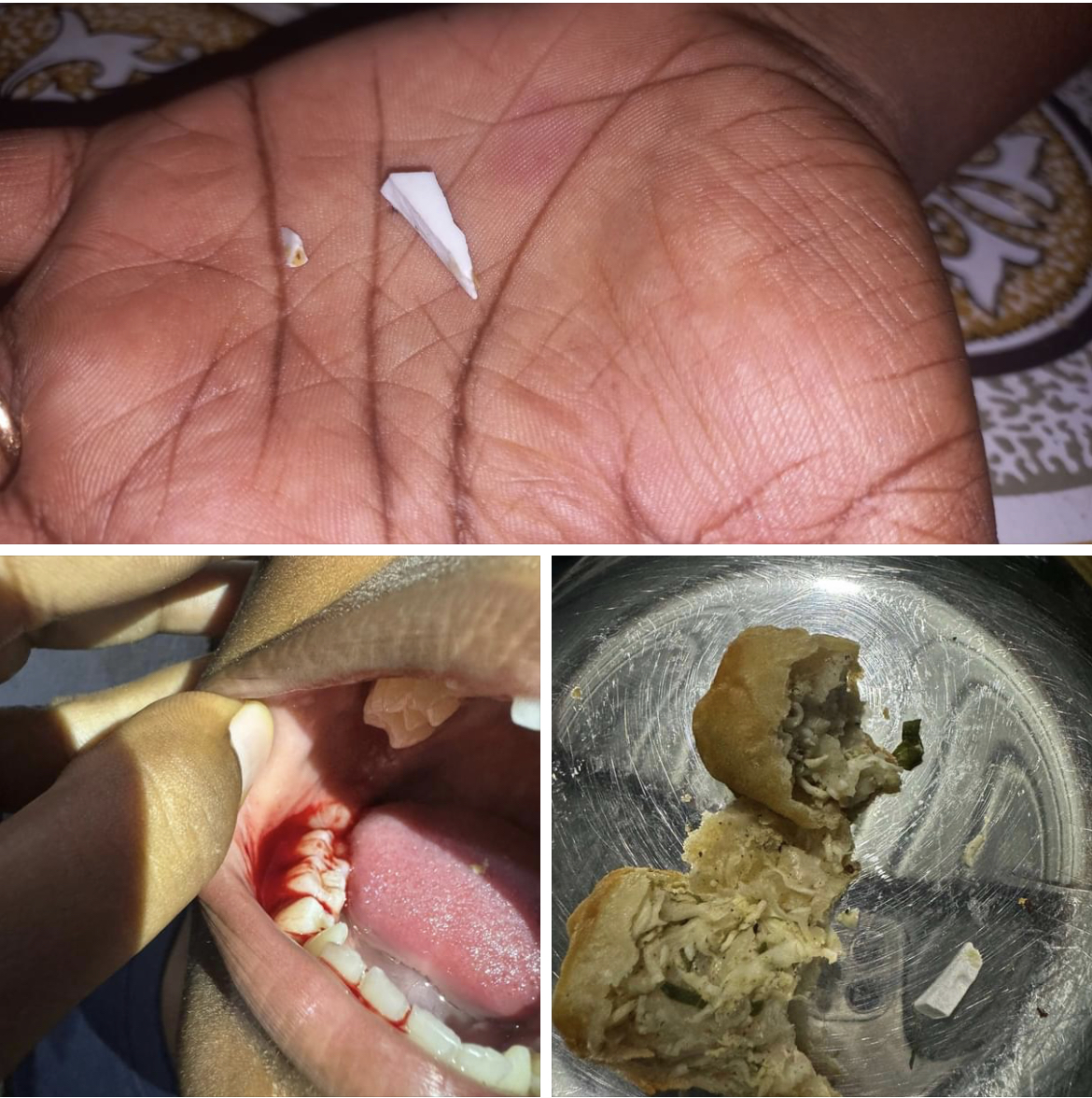 ހެދިކާއެއްގެ ތެރޭގައި އޮތް ތޫނު އެއްޗަކުން ކުޑަ ކުއްޖެއްގެ އަނގައިގެ ހިރުގަނޑު ޒަހަމްވެއްޖެ